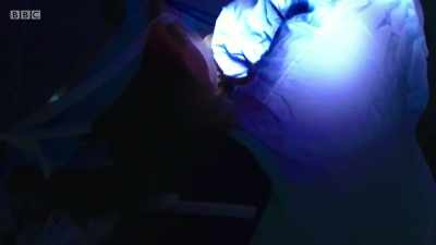 But you're cutting up people's
faces, - Surgeons: At the Edge of Life