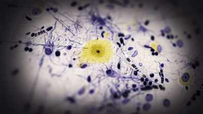 CAHALAN:
But this idea that we - Mysteries of Mental Illness