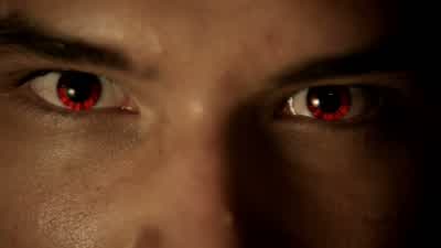 Can you get turned by a scratch? - Teen Wolf