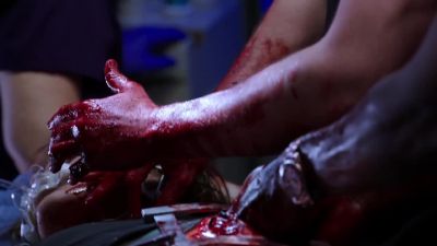 - Carotid clamps are on. - Chicago Med