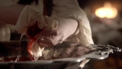 Catherine: Why won't
his ear stop bleeding? - Reign