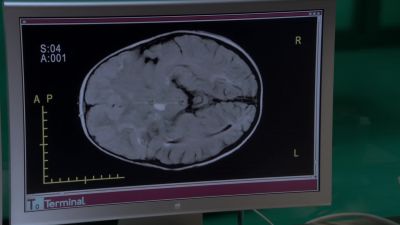 Chase: It's neurological. - House