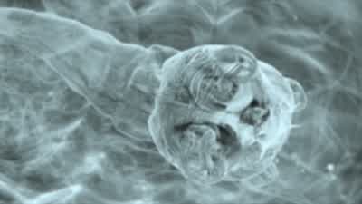 Chase: This here is a worm larva. - House