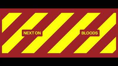 Chest pains, male, sixties, oh! - Bloods