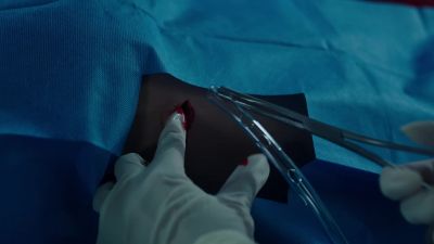 Chest tube to me. - The Resident