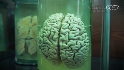 -Chronic traumatic
encephalopathy, or CTE, - The Nine Lives of Vince McMahon