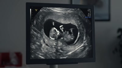 (chuckles) - The Pregnancy Scheme