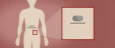 Clients at the
treatment centers, - Body Brokers