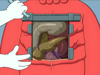 Commencing excavation of subject's chest cavity. - Futurama