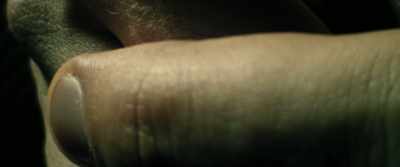 Conventional
medication for HIV - Citizen Bio
