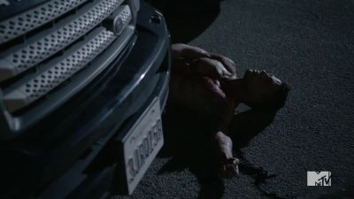 [Coughs, sputters] - Teen Wolf