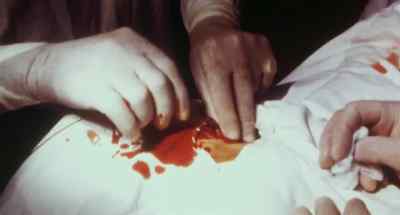 Could it be that cancer
is a man-made disease? - Faces of Death