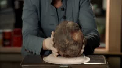 Cranial shape and nasal features suggest Caucasian. - Bones