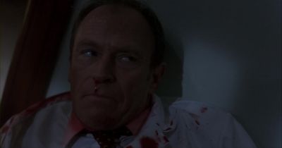 Damn cap just won't stay in - The Dentist 2