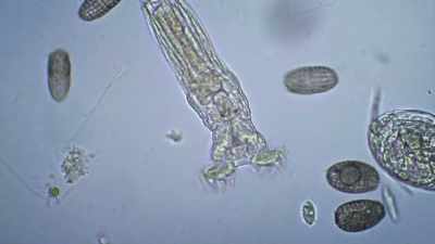 - [Dan] It is
the bdelloid rotifer, - The UnBelievable with Dan Aykroyd