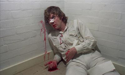 DELTOID Oh dear This boy does look a mess doesn't he - A Clockwork Orange