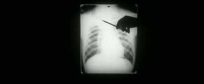 Dickie got TB, tuberculosis,
and it just swept Ireland. - The Ghost of Richard Harris