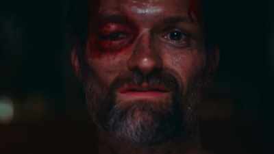-Did you know you were going
to kill me - A Wounded Fawn
