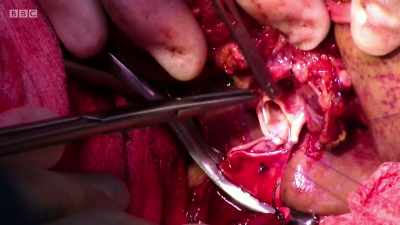 Do you see what I am doing? - Surgeons: At the Edge of Life