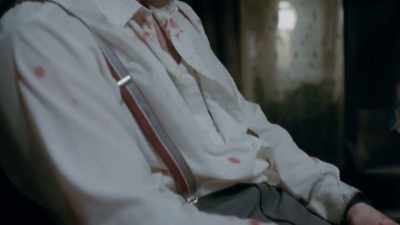 Do you think that - DAU. Degeneration