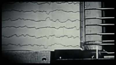 Doctor: Electrical stimulation was carried out at 60 cycles - The Minds of Men