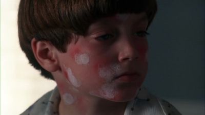 DOCTOR He's not allergic to the bees so there's no real problem - Avalon