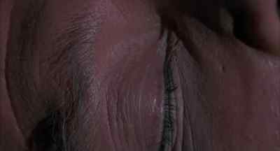Does this hurt? You have a hematoma there. - The Naked Face