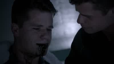 Does it hurt you as much as it hurts me? - Teen Wolf