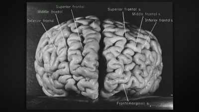 "does my patient have kidney
cancer, dr. Harvey?" - The Man Who Stole Einstein's Brain