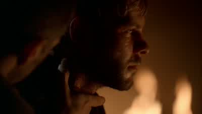 Does that hurt? - Lost