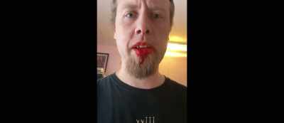 Don't forget to like
and subscribe and share. - 5G Zombies