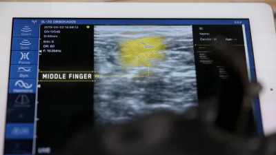 [Downey] Ultrasound
uses high-frequency sound waves - The Age of A.I.
