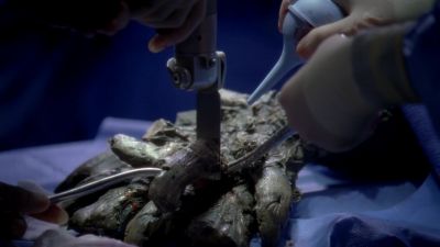 Dr. Bailey, how can you tell - Grey's Anatomy