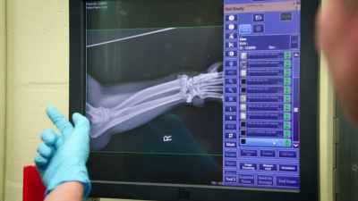 DR. DIANA: The elbow looks really...
actually really good on x-rays. - Magic of Disney's Animal Kingdom