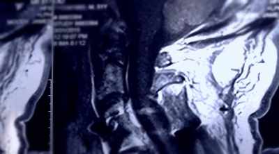 Dr. Duntsch felt that
he had encountered - Dr. Death: The Undoctored Story