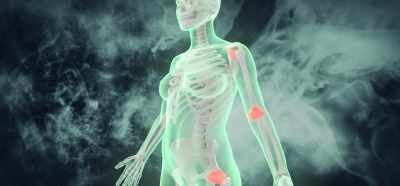 [Dr. Ewing] Every bone
in your body is connected - Root Cause