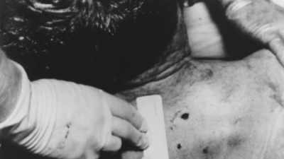 Dr. Humes could not find any point of exit - JFK: What The Doctors Saw