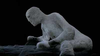 Dr lazer: So certainly
they'd have pain, swelling, - Pompeii: Secrets of the Dead