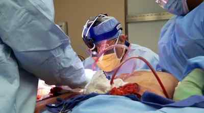 Dr. Nowzaradan:
THIS LYMPHEDEMA MASS IS
INTERFERING WITH HIS WALKING. - My 600-lb Life