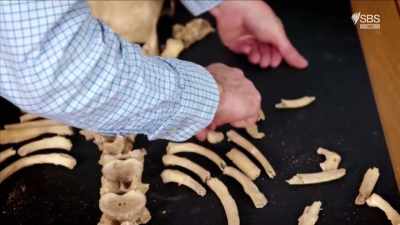 Dr Piers Mitchell
is a palaeopathologist - Curse of the Ancients with Alice Roberts