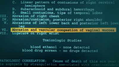 Dr. Spitz: It's quite evident
that there has been an assault - How It Really Happened