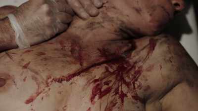 Draw some blood
and get it back to me
as quick as possible. - Squealer