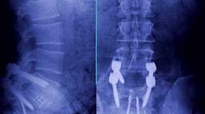 Duntsch also left hardware. - Dr. Death: The Undoctored Story