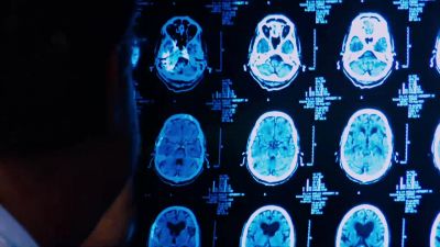 Egnor there's nothing to be learned in neurosurgery - Expelled: No Intelligence Allowed