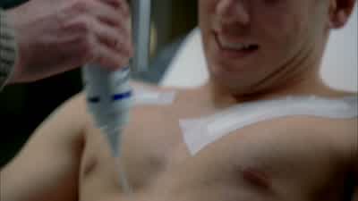 Electro-conductive gel for the ultrasound. - Fringe