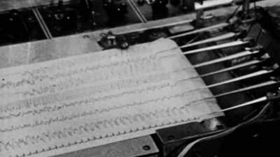Electrodes can carry currents into the brain - The Minds of Men