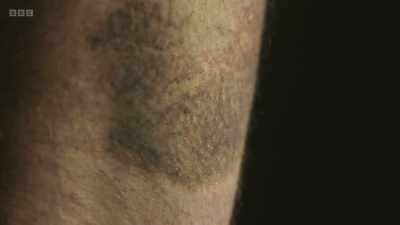 Even the smallest of injuries
can have a potentially
devastating effect. - The Human Body: Secrets of Your Life Revealed