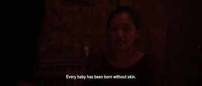 Every baby has been born without skin. - Impetigore