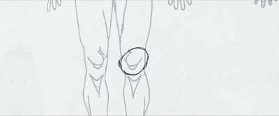 Everyone that went in there had
a herniation, a bulging disc -- - American Pain