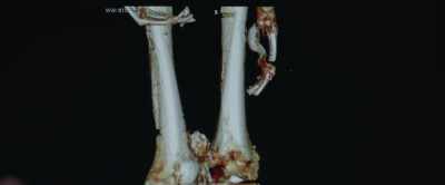 - Falling down from a
high impact from racing - Tutankhamun: Allies & Enemies